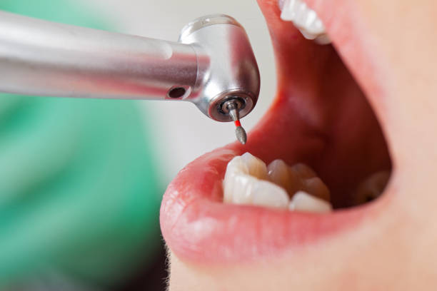 Best Emergency Dental Surgery in Milford Mill, MD